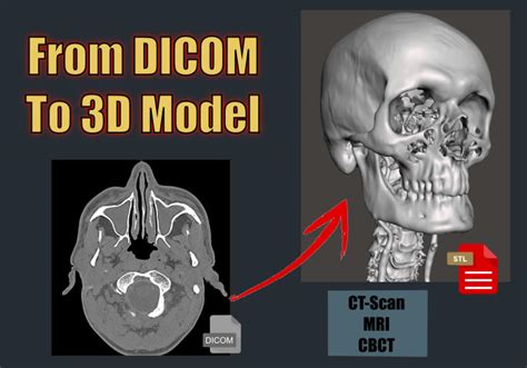 dicom to 3d model.